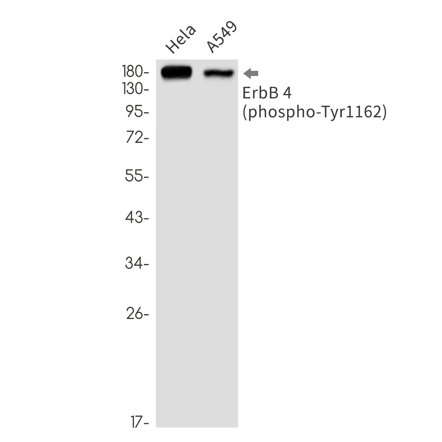 Phospho-ErbB 4 (Tyr1162) Rabbit mAb